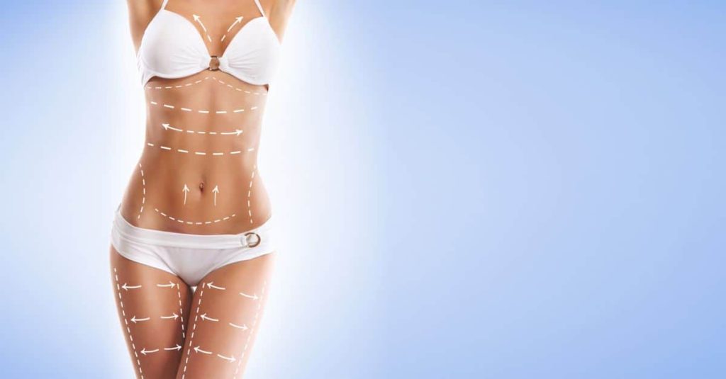 liposuctia–sculptura unui corp perfect