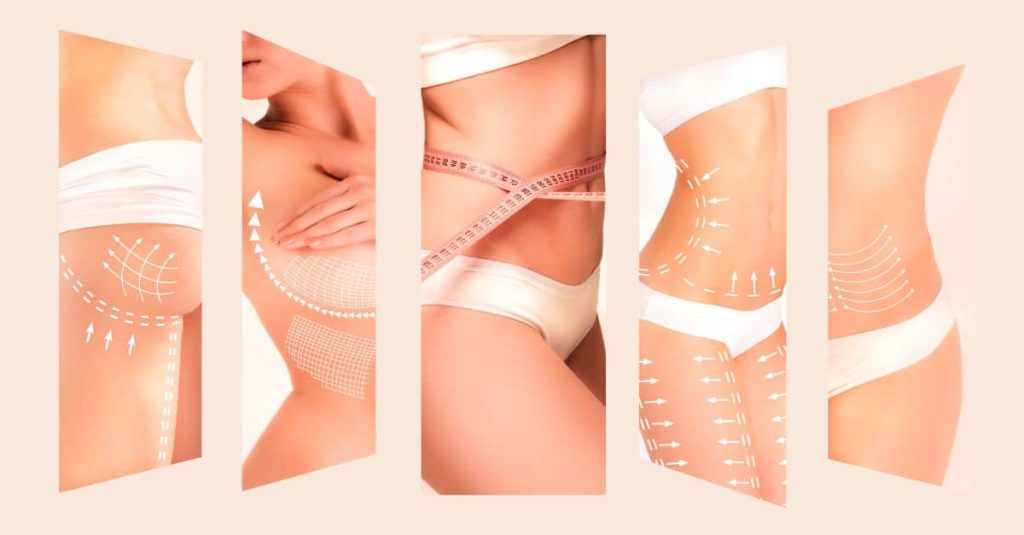 operatii estetice populare