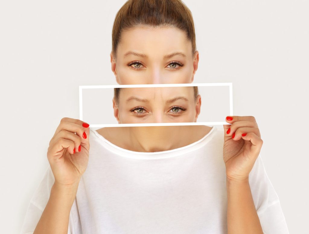 blefaroplastie inferioara