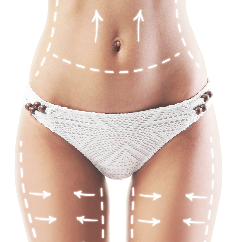 Abdominoplastie Bucuresti, semne pe corp unde se poate efectua Abdominoplastia | Dr. Cristian Nitescu