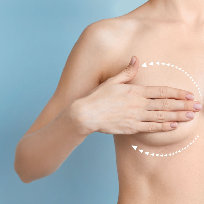 De ce să alegi implantul mamar anatomic?