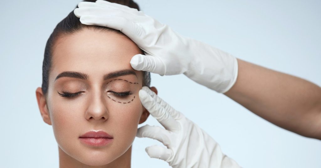 Operația pentru pleoape căzute- blefaroplastie - Dr. Nițescu